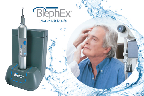 graphic depicting the BlephEx treatment in use