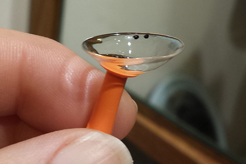 Picture of the scleral lens